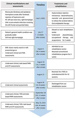 Multi-modal fMRI and TMS follow-up study of motor cortical stroke caused by hyaluronic acid filler: A case report